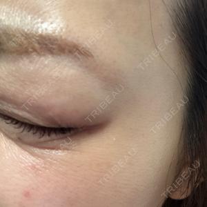 AB美容クリニック AB美容クリニック 新宿院口コミ