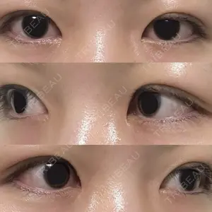 LUHO（ルホ）美容外科口コミ