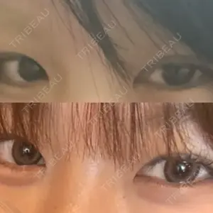LUHO（ルホ）美容外科口コミ