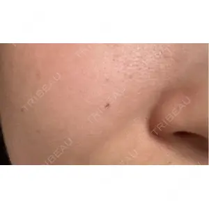 やさしい美容皮膚科・皮フ科 やさしい美容皮膚科・皮フ科　東京浅草院口コミ