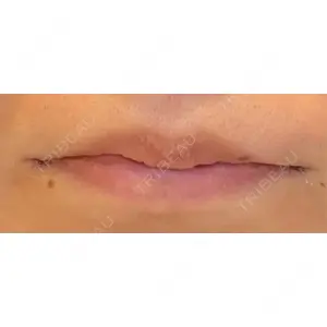 LOUIS CLINIC 二子玉川院【ルイクリニック】口コミ