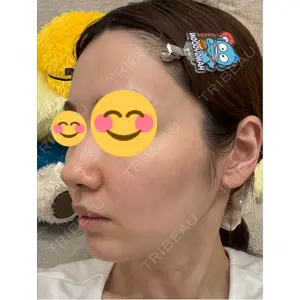 HAAB CLINIC HAAB BEAUTY CLINIC 名古屋院口コミ