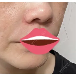 プロクリニック PRO CLINIC プロクリニック 銀座院口コミ