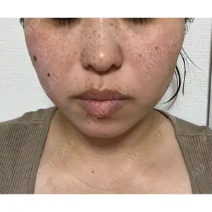 ルラ美容クリニック ルラ美容クリニック 渋谷本院口コミ