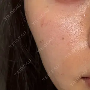AZ BEAUTY CLINIC口コミ