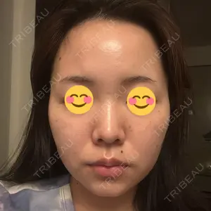 TCB東京中央美容外科 TCB東京中央美容外科 藤沢院口コミ