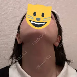 美容皮膚科ティファクリニック 美容皮膚科ティファクリニック 横浜院口コミ