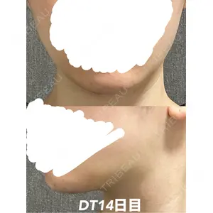 HAAB CLINIC HAAB CLINIC 福岡院口コミ