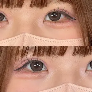 口コミ