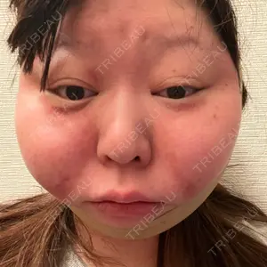 アリエル美容クリニック アリエル美容クリニック 大宮院口コミ
