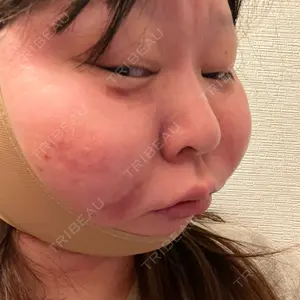 アリエル美容クリニック アリエル美容クリニック 大宮院口コミ