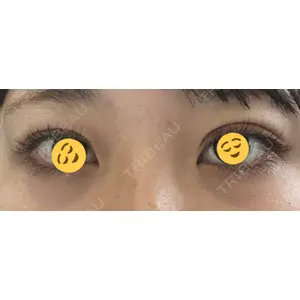 TCB東京中央美容外科 TCB東京中央美容外科 京都四条院口コミ