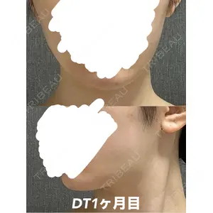 HAAB CLINIC HAAB CLINIC 福岡院口コミ