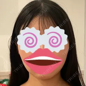 口コミ