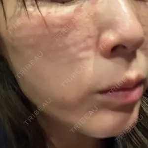 ミニマムスキンクリニック ミニマムスキンクリニック銀座口コミ