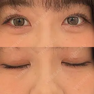 東京シンデレラ美容外科 東京シンデレラ美容外科 池袋院口コミ