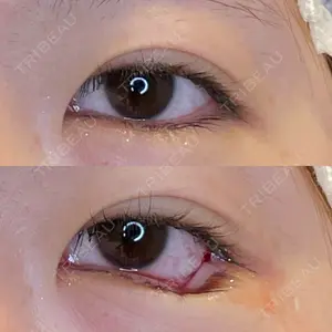 LOUIS CLINIC 二子玉川院【ルイクリニック】口コミ