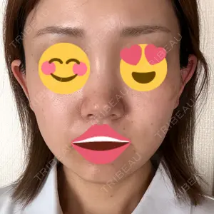 APスキンクリニック銀座口コミ