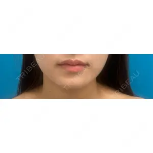 HAAB CLINIC HAAB CLINIC 池袋院口コミ