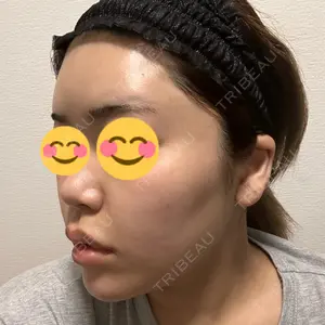 BIZENNクリニック【ビゼンクリニック】口コミ