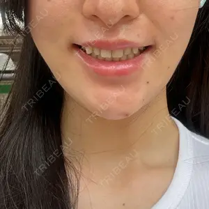 HAAB CLINIC HAAB CLINIC 池袋院口コミ