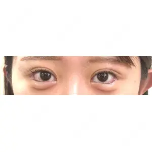 LOUIS CLINIC 二子玉川院【ルイクリニック】口コミ
