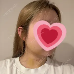 R Beauty CLINIC R Beauty CLINIC 銀座院口コミ