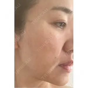 Nebula Clinic 札幌美容外科ネビュラクリニック口コミ