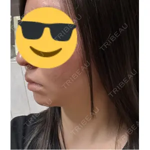 HAAB CLINIC HAAB CLINIC 池袋院口コミ