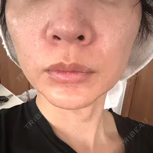 ルラ美容クリニック ルラ美容クリニック 名古屋本院口コミ