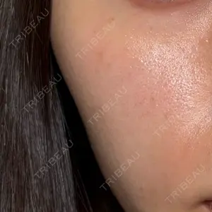 AZ BEAUTY CLINIC口コミ