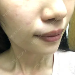 HAAB CLINIC HAAB CLINIC 池袋院口コミ