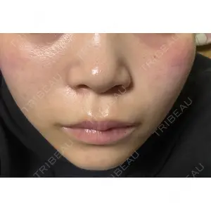 BITO BEAUTY CLINIC BITO BEAUTY CLINIC口コミ