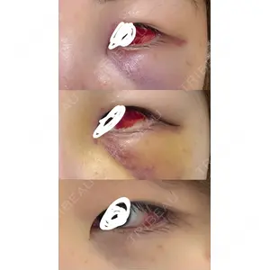 LA CLEF CLINIC（ラクレクリニック）口コミ
