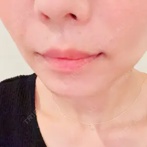 ルラ美容クリニック ルラ美容クリニック 大阪心斎橋院口コミ