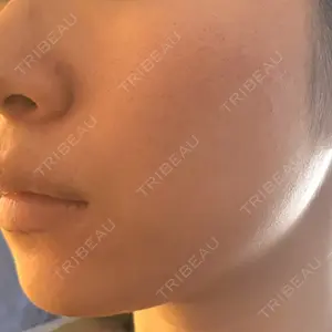 HAAB CLINIC HAAB BEAUTY CLINIC 名古屋院口コミ