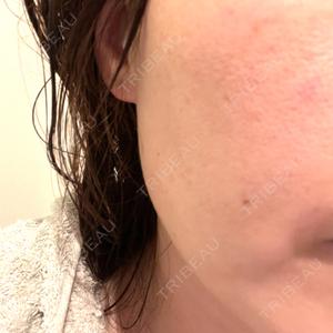 ARTE BEAUTY CLINIC口コミ