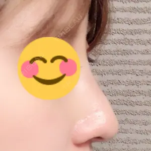 口コミ