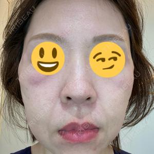 LIFIX BEAUTY CLINIC口コミ