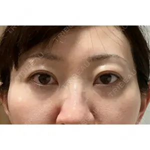 ミニマムスキンクリニック ミニマムスキンクリニック銀座口コミ