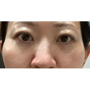 ミニマムスキンクリニック ミニマムスキンクリニック銀座口コミ