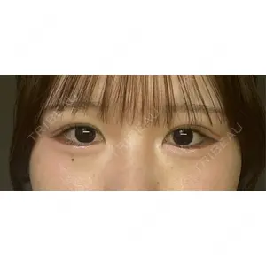 東京シンデレラ美容外科 東京シンデレラ美容外科 池袋院口コミ