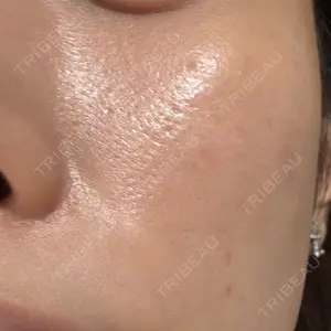 muni skin clinic muni skin clinic口コミ