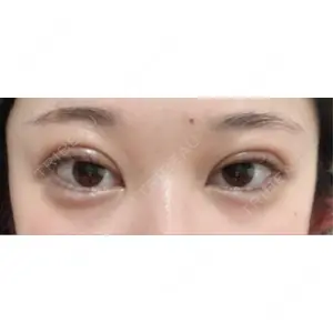 東京シンデレラ美容外科 東京シンデレラ美容外科 池袋院口コミ