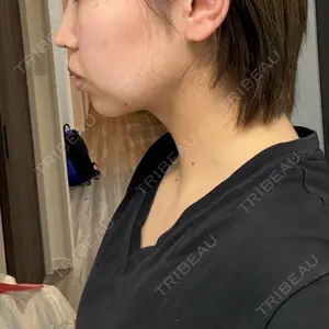 脂肪吸引ラボトウキョウ口コミ