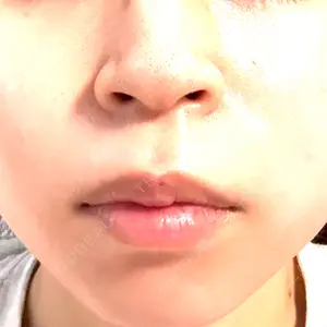 おおかみ美容のクリニック おおかみ美容のクリニック 新宿院口コミ