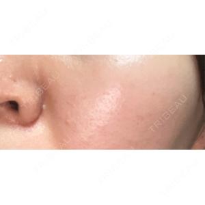 Fellez Clinic【フェルズクリニック】口コミ