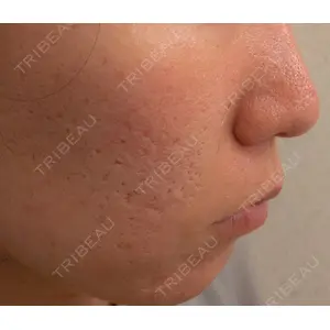 エルムクリニック 美容皮膚科エルムクリニック 岡山院口コミ