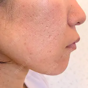 エルムクリニック 美容皮膚科エルムクリニック 岡山院口コミ