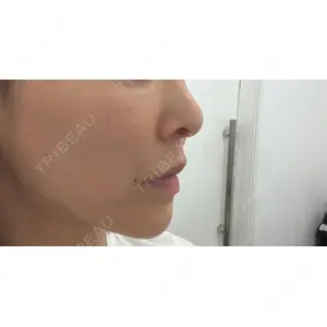 LA CLEF CLINIC（ラクレクリニック）口コミ